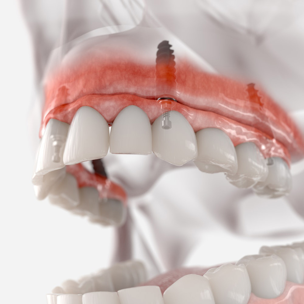 East Brunswick Dentures