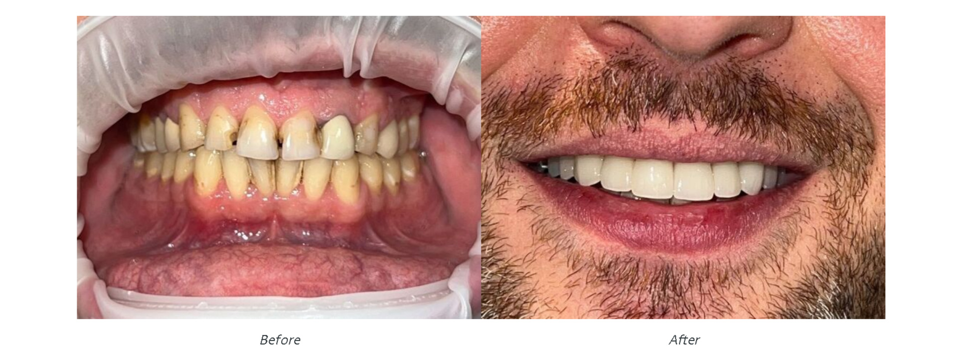 Family Dentist in East Brunswick